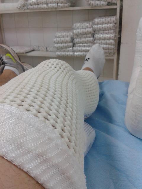 Ruptura partiala de ligament, picior ghips